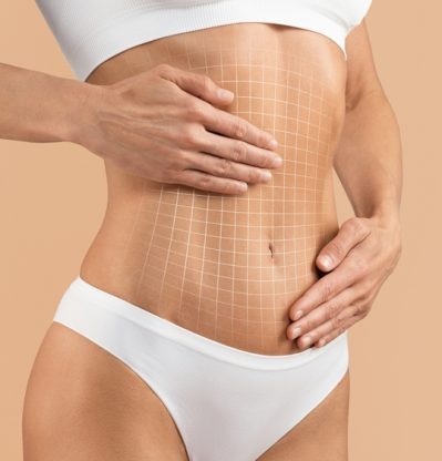 Tummy,Tuck.,Cropped,Shot,Of,Female,Body,With,Flat,Abdomen