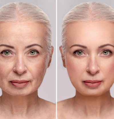 Portrait,Of,A,Gray-haired,Woman,After,60,Years,Before,And